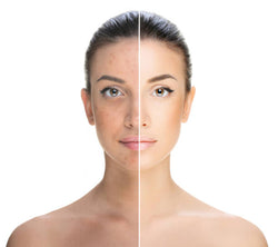 TRAITEMENT esthétique des TACHES PIGMENTAIRES – Uniformisez votre teint et éliminez les irrégularités. — institut Cosmesud à Baillargues