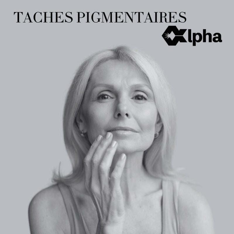 Élimination des taches pigmentaires par laser Alpha System à Baillargues