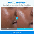 No.3 Blue Bio-Retinol Pore Refining Serum (30 ml) - Numbuzin