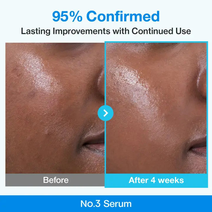 No.3 Blue Bio-Retinol Pore Refining Serum (30 ml) - Numbuzin
